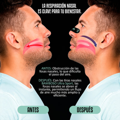 Sport-Nasenpflaster – Besser atmen, bessere Leistung bringen